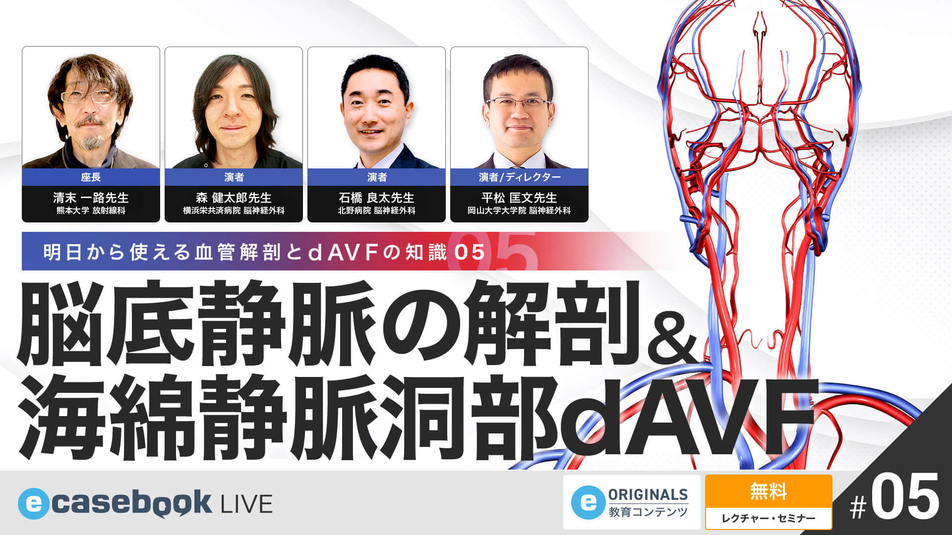VIDEO 脳底静脈の解剖＆海綿静脈洞部dAVF Neurology ・ Neurosurgery ecasebook LIVE