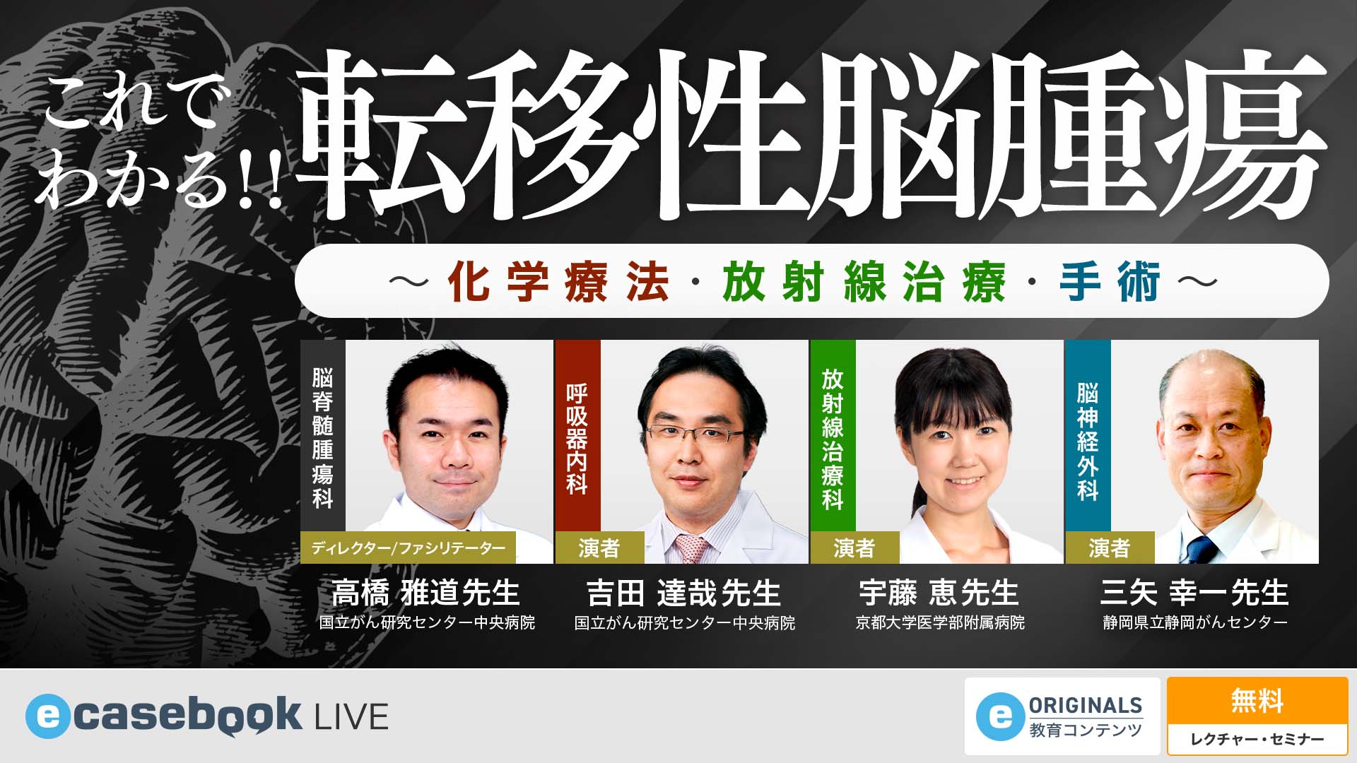 VIDEO: これでわかる！！転移性脳腫瘍～化学療法・放射線治療・手術