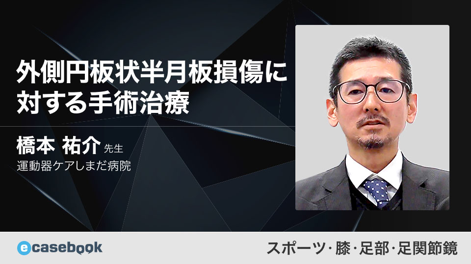 スポーツ 膝・足部・足関節鏡 | e-casebook